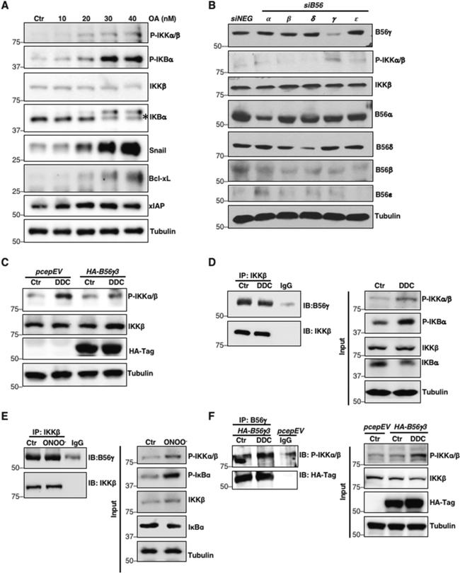 IKK beta Antibody in Western Blot, Immunoprecipitation (WB, IP)