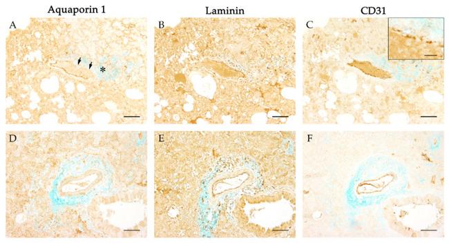 Aquaporin 1 Antibody in Immunohistochemistry, Immunohistochemistry (Paraffin) (IHC, IHC (P))