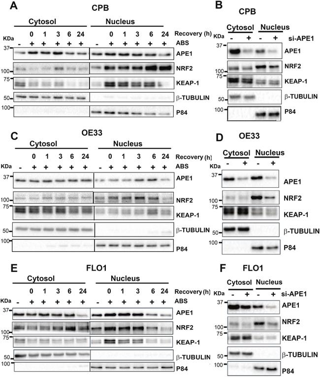 APE1 Antibody in Western Blot (WB)