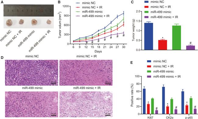 CK2 alpha-1 Antibody in Immunohistochemistry (IHC)