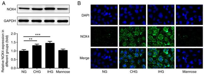 NOX4 Antibody in Western Blot, Immunocytochemistry (WB, ICC/IF)