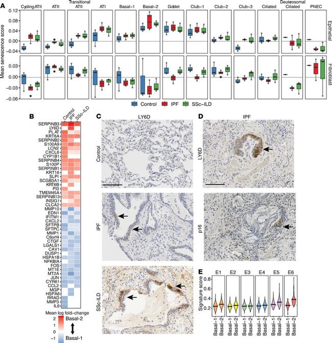 LY6D Antibody in Immunohistochemistry (IHC)