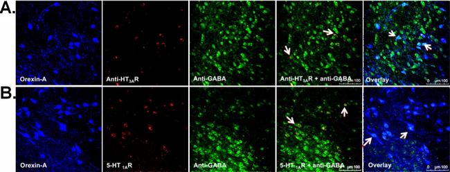 Goat IgG (H+L) Cross-Adsorbed Secondary Antibody in Immunocytochemistry (ICC/IF)