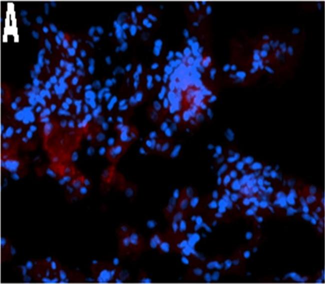 Mouse IgG (H+L) Cross-Adsorbed Secondary Antibody in Immunohistochemistry (Frozen) (IHC (F))