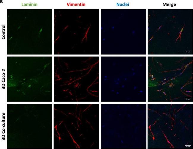 Mouse IgG (H+L) Cross-Adsorbed Secondary Antibody in Immunocytochemistry (ICC/IF)