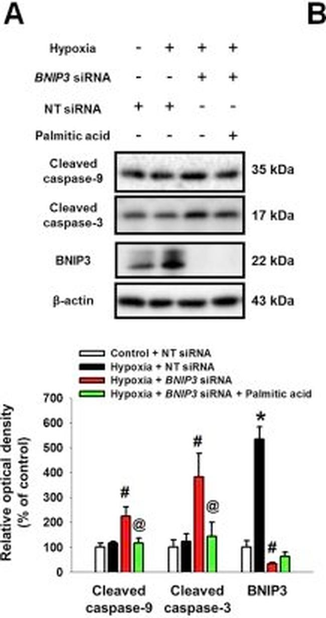 Rabbit IgG (H+L) Secondary Antibody in Western Blot (WB)