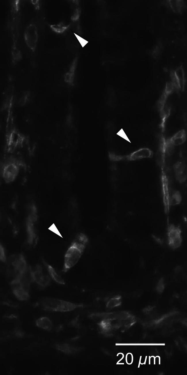 Goat IgG (H+L) Cross-Adsorbed Secondary Antibody in Immunohistochemistry (IHC)