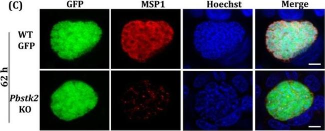 Mouse IgG (H+L) Highly Cross-Adsorbed Secondary Antibody in Immunohistochemistry (IHC)