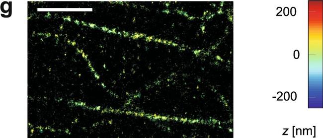 Rabbit IgG (H+L) Highly Cross-Adsorbed Secondary Antibody in Immunocytochemistry (ICC/IF)