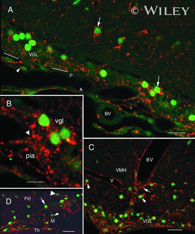 Connexin 26 Antibody in Immunohistochemistry (IHC)