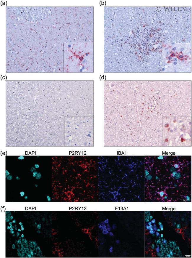 Factor XIII A Antibody in Immunohistochemistry (IHC)