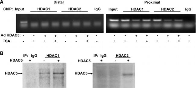 HDAC2 Antibody in Western Blot, Immunoprecipitation, ChIP Assay (WB, IP, ChIP)