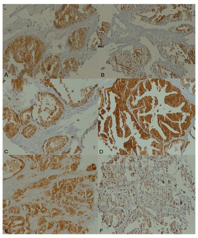 EBP50 Antibody in Immunohistochemistry (IHC)