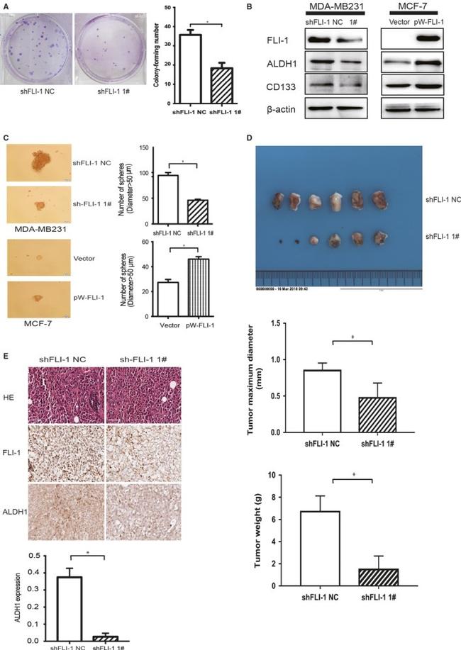 ALDH1A1 Antibody in Immunohistochemistry (IHC)