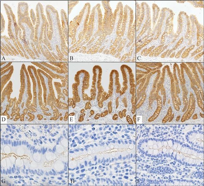 ZO-1 Antibody in Immunohistochemistry (IHC)