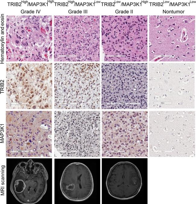 TRIB2 Antibody in Immunohistochemistry (IHC)