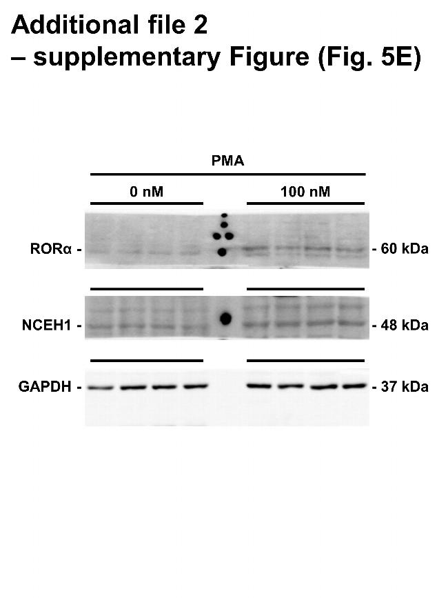 NCEH1 Antibody in Western Blot (WB)