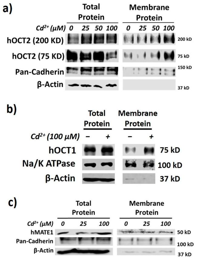 SLC22A1 Antibody in Western Blot (WB)