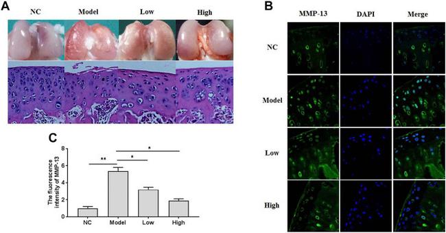 MMP13 Antibody in Immunohistochemistry (IHC)