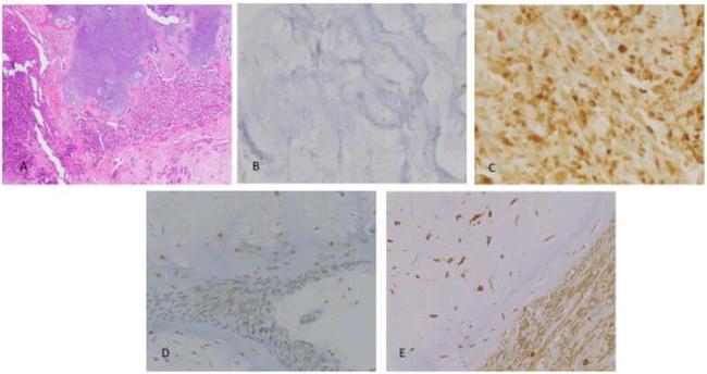 VEGF Antibody in Immunohistochemistry (IHC)