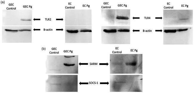 SOCS1 Antibody in Western Blot (WB)