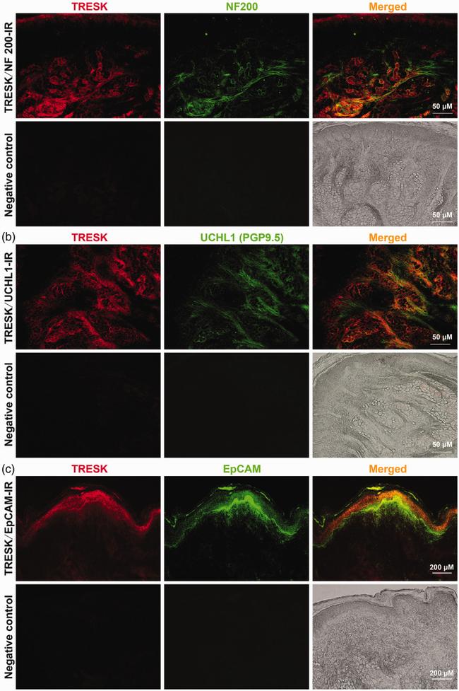 EpCAM Antibody in Immunohistochemistry (IHC)