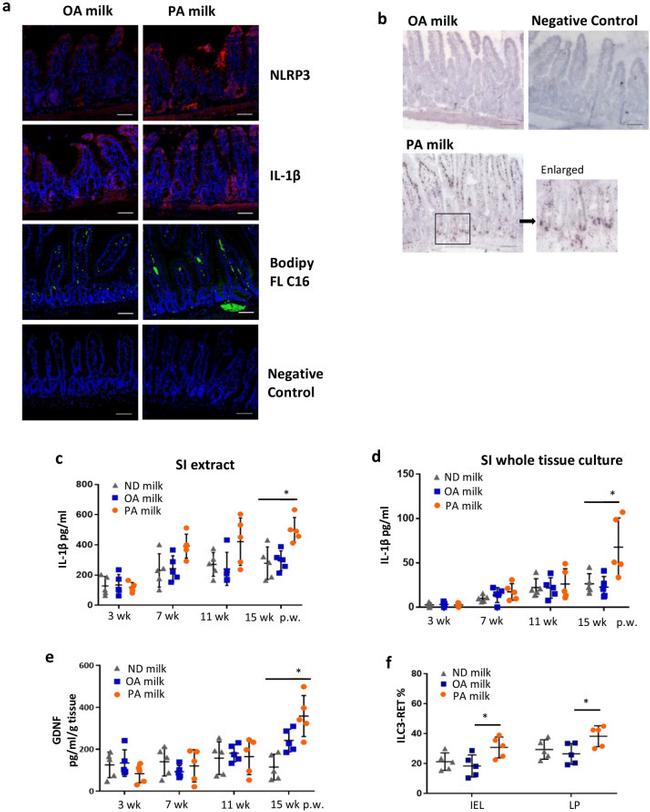 IL-1 beta Antibody in Immunohistochemistry (IHC)