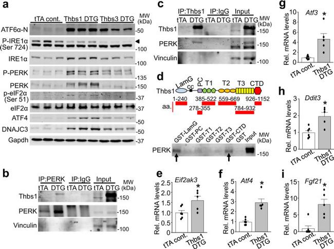 Thrombospondin 1 Antibody in Western Blot, Immunoprecipitation (WB, IP)