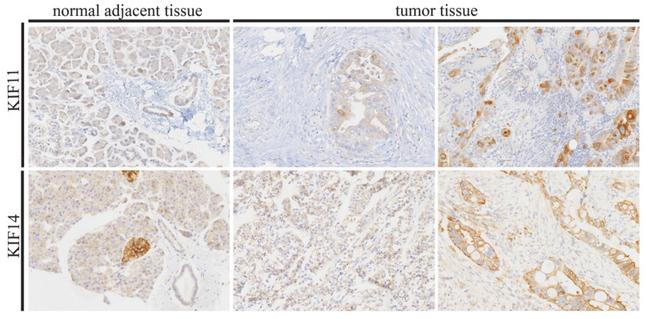 KIF11 Antibody in Immunohistochemistry (IHC)