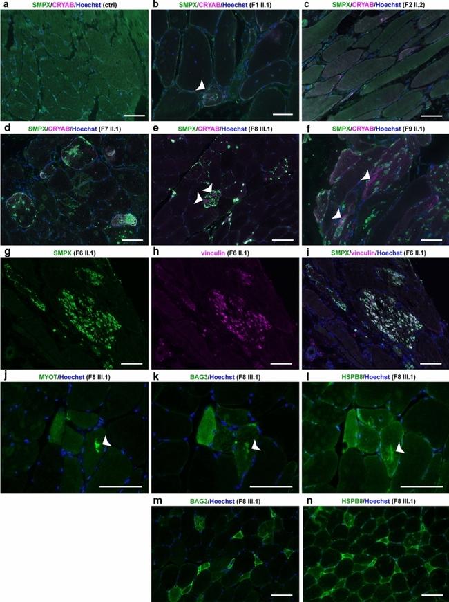 SMPX Antibody in Immunohistochemistry (IHC)