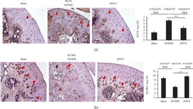 IL-17A Antibody in Immunohistochemistry (IHC)