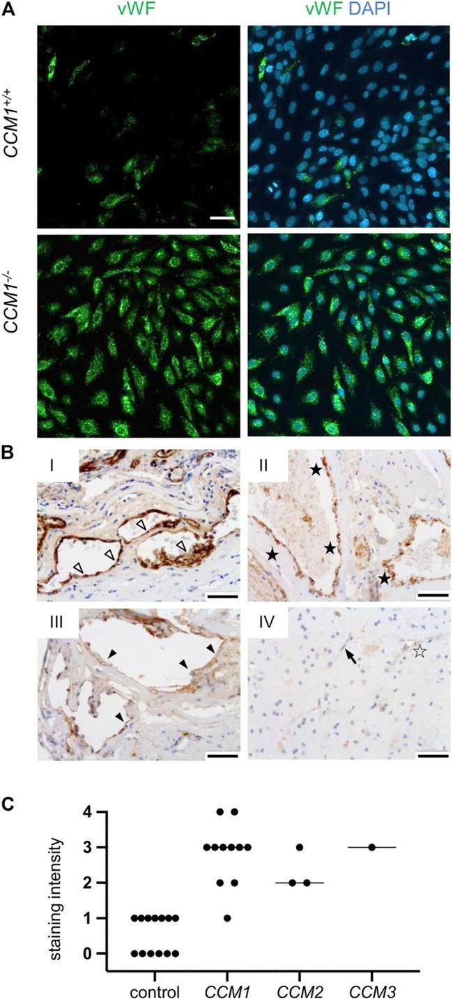 VWF Antibody in Immunocytochemistry (ICC/IF)