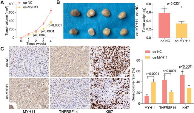 TNFRSF14 Antibody in Immunohistochemistry (IHC)