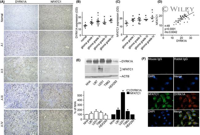 NFATC1 Antibody in Western Blot, Immunohistochemistry (WB, IHC)