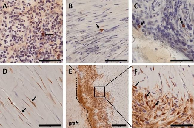 ErbB4 Antibody in Immunohistochemistry (IHC)