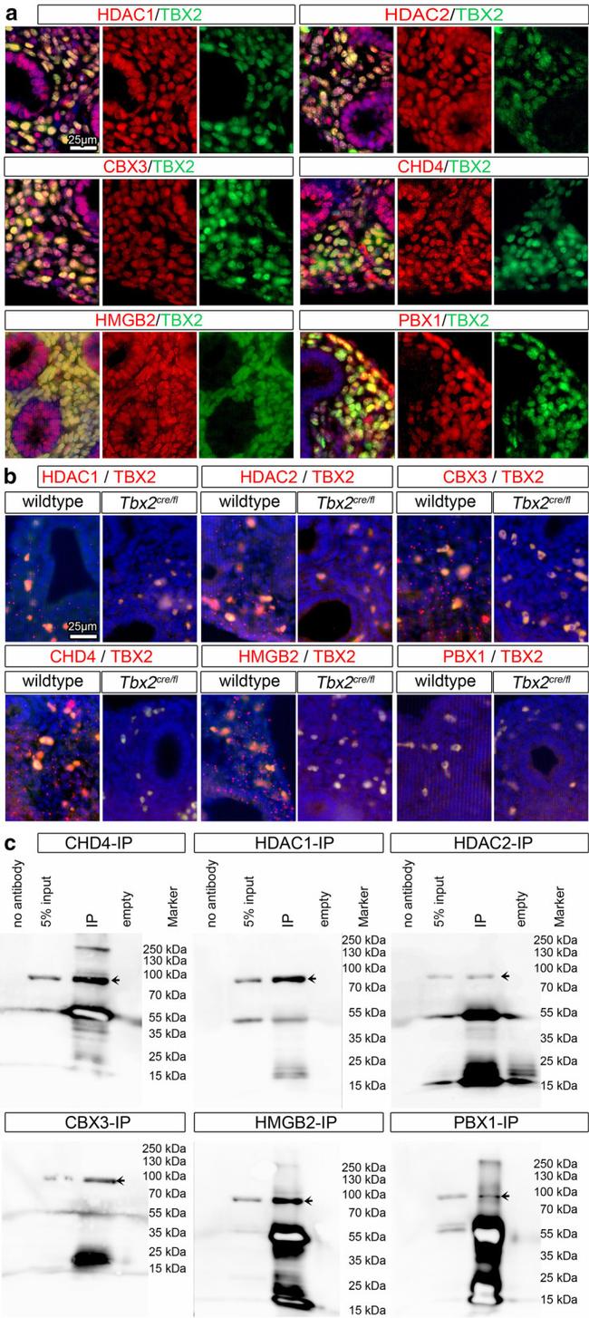 HDAC1 Antibody in Immunocytochemistry, Immunohistochemistry (Paraffin) (ICC/IF, IHC (P))