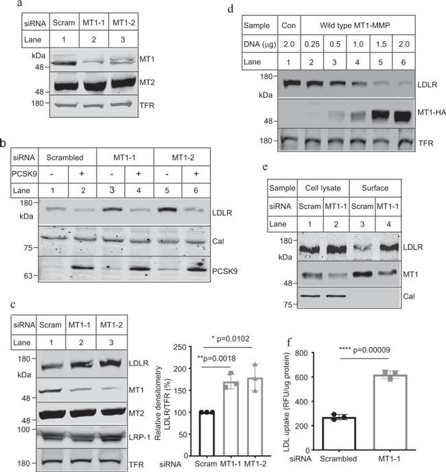 MMP15 Antibody in Western Blot (WB)