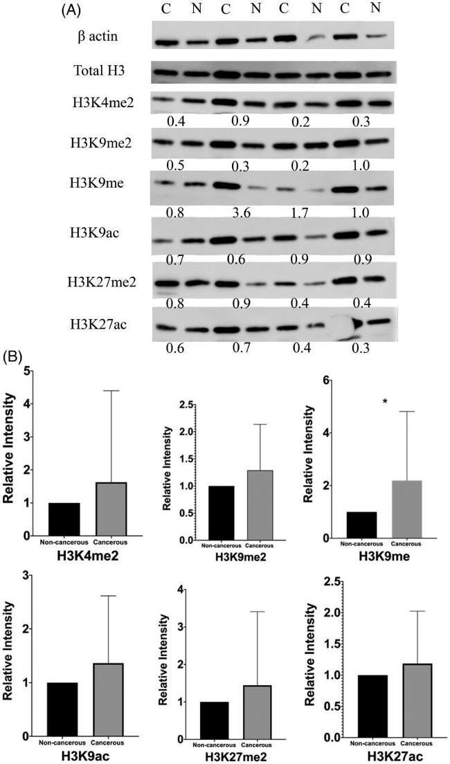 H3K27ac Antibody in Western Blot (WB)