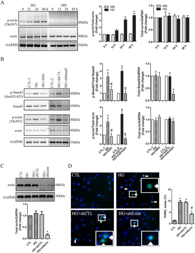 Ezrin Antibody in Western Blot (WB)