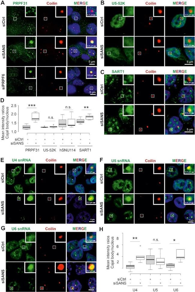 SART1 Antibody in Immunocytochemistry (ICC/IF)