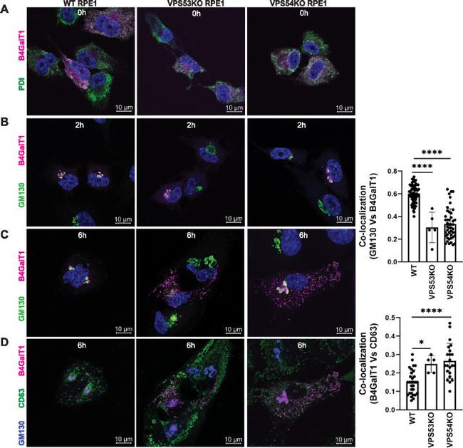 PDI Antibody in Immunocytochemistry (ICC/IF)