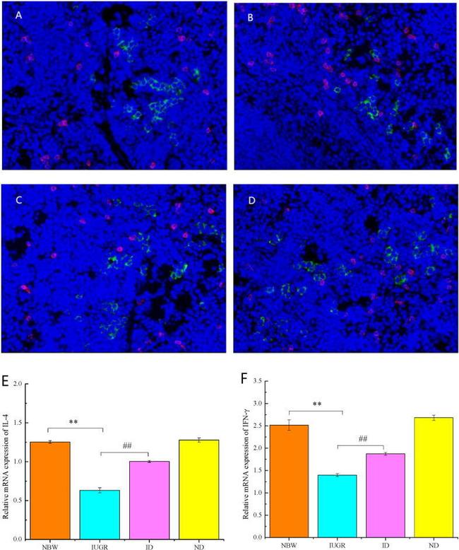 CD4 Antibody in Immunohistochemistry (Paraffin) (IHC (P))