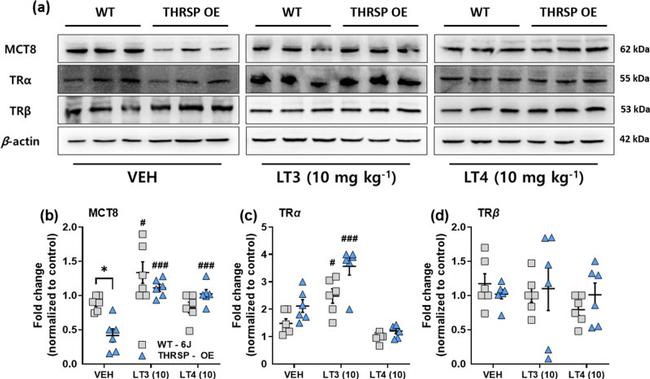 THRB Antibody in Western Blot (WB)