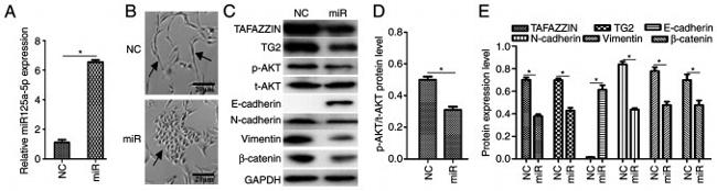 beta Catenin Antibody in Western Blot (WB)