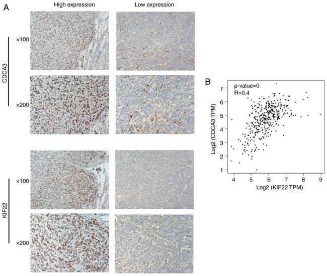 KID Antibody in Immunohistochemistry (IHC)