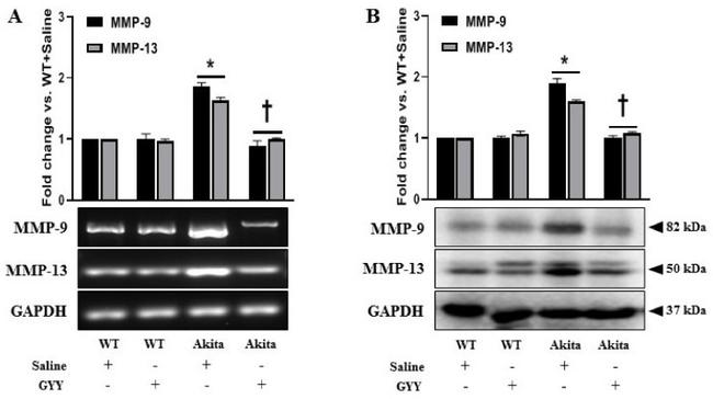 MMP9 Antibody in Western Blot (WB)