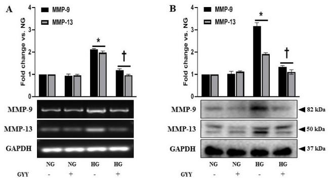 MMP9 Antibody in Western Blot (WB)