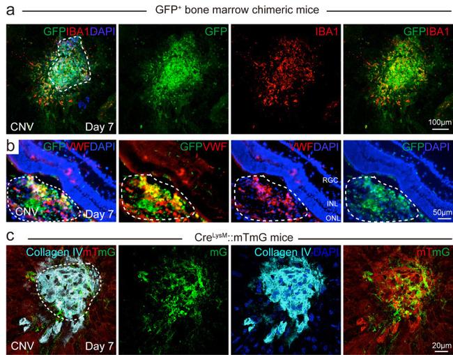 VWF Antibody in Immunohistochemistry (IHC)