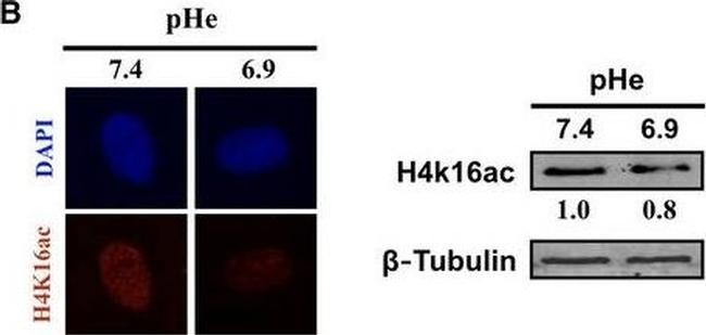 Mouse IgG (H+L) Secondary Antibody in Western Blot (WB)