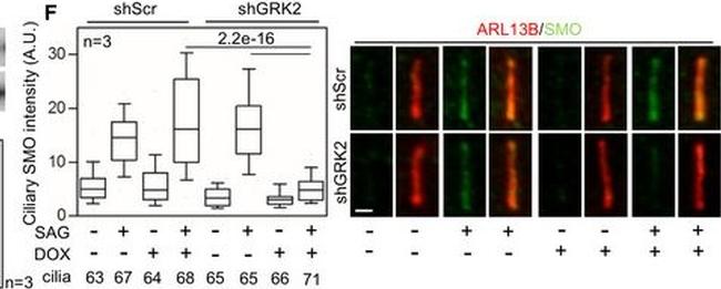 Rabbit IgG (H+L) Highly Cross-Adsorbed Secondary Antibody in Immunohistochemistry (IHC)